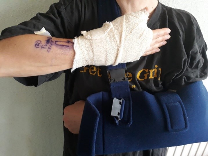 Bandaged and slung up